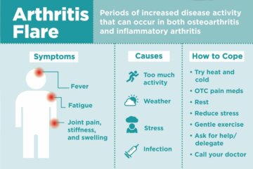 Can Exercise Cause a Rheumatoid Arthritis Flare-Up