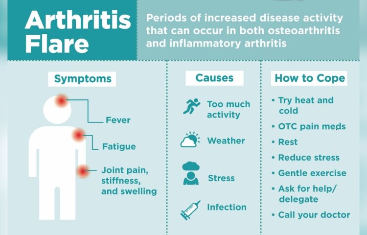 Can Exercise Cause a Rheumatoid Arthritis Flare-Up