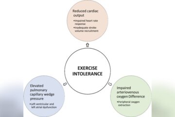 How to Exercise With Exercise Intolerance