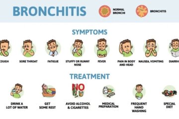 Should You Exercise With a Chest Infection