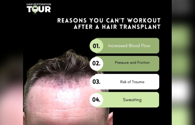 Why Can'T I Exercise After Hair Transplant