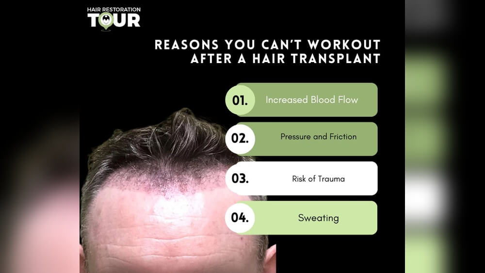 Why CanT I Exercise After Hair Transplant Radiant Glow Health Why CanT I Exercise After Hair Transplant