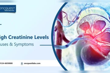 Will Exercise Affect My Creatinine Levels