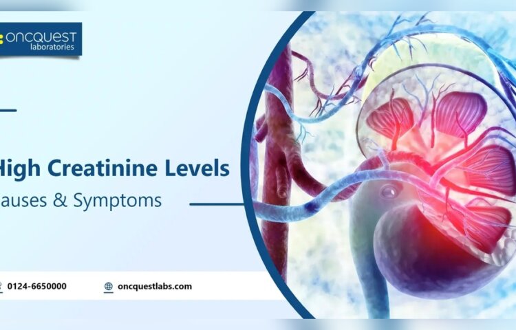 Will Exercise Affect My Creatinine Levels
