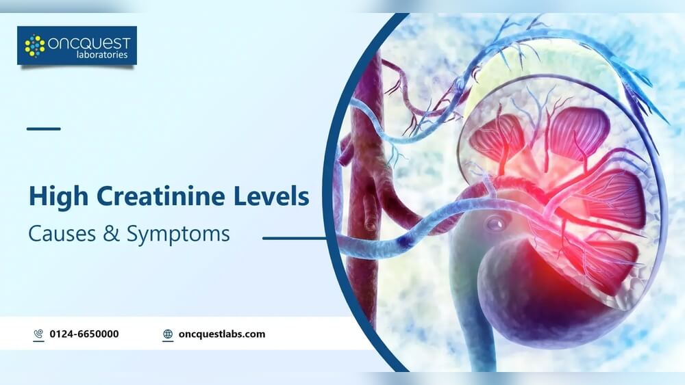 Will Exercise Affect My Creatinine Levels